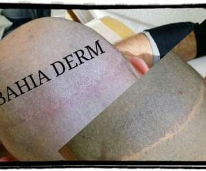 Bahia Derm - Specialiste Dermographe   