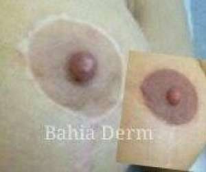 photo Bahia derm - specialiste dermographe    Grasse 14960