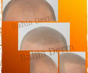 photo Bahia derm - specialiste dermographe    Grasse 14961