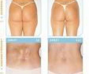 photo Institut beaute minceur Limoges 2960