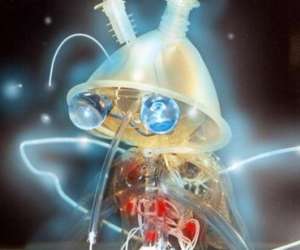 photo Compagnie pas de l�se-art spectacles Aniane 10479